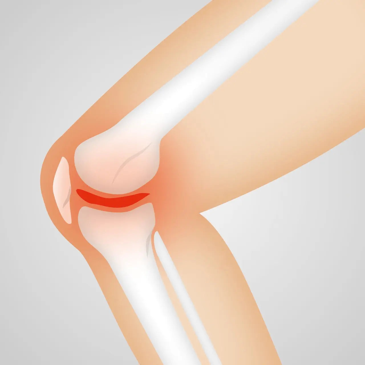 Can We Really Regenerate Cartilage?