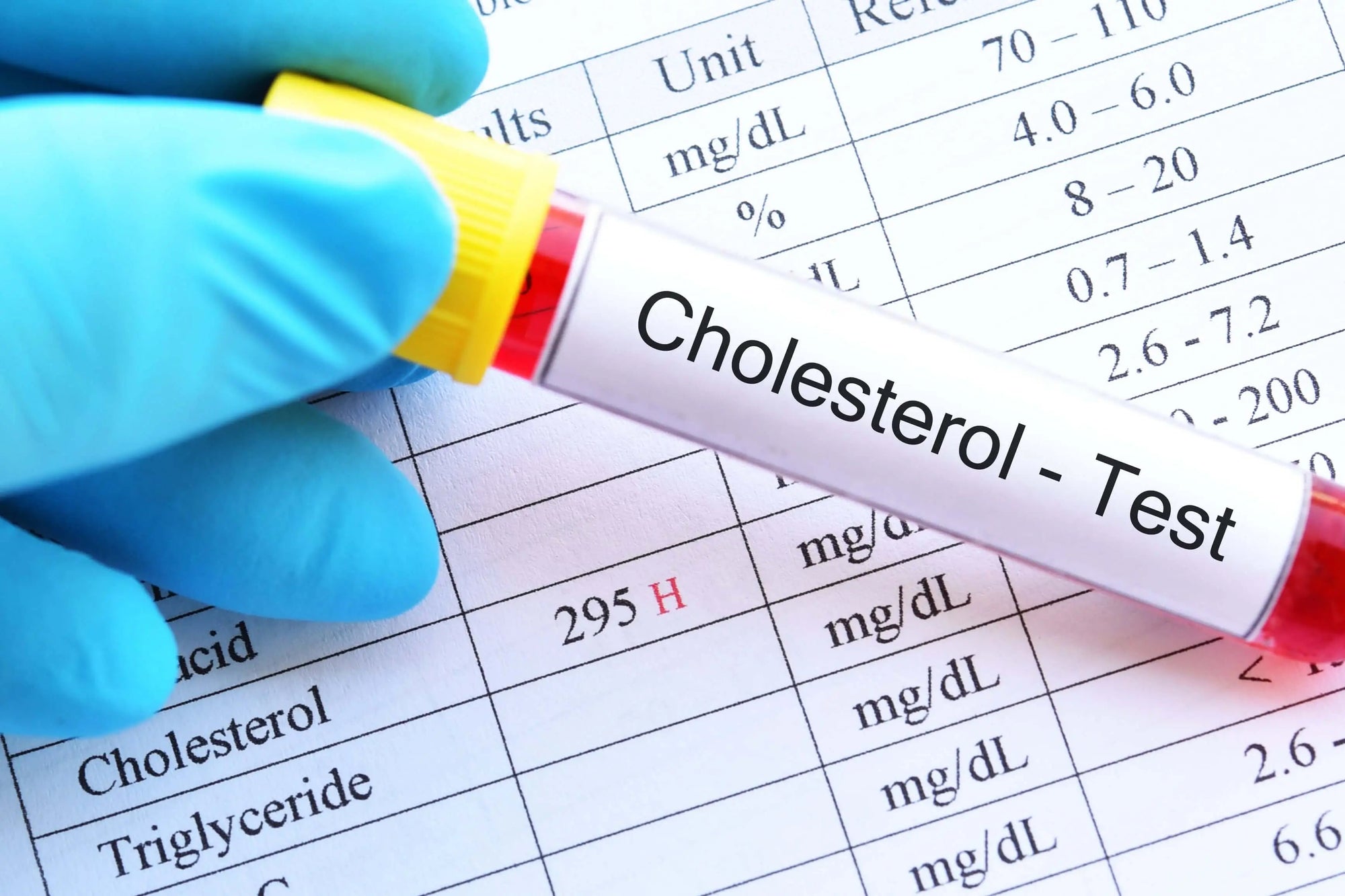 Eating-Heart-Can-Affect-Blood-Cholesterol DR GUS nutrition