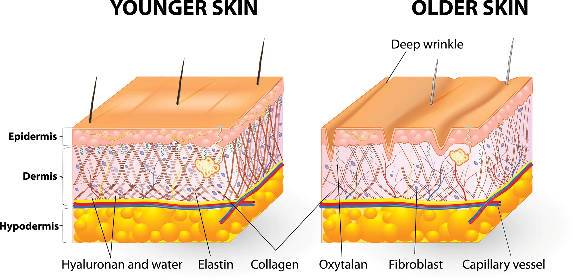 Why Bone Broth is Collagen+++